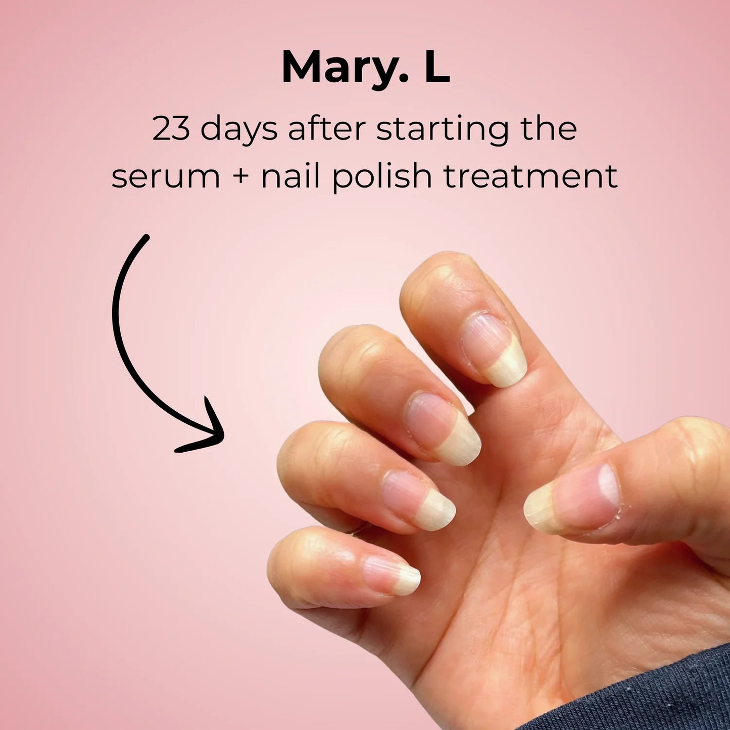 Evoluna Nail Growth Serum