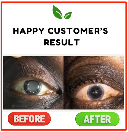 Moadop Eye Tea